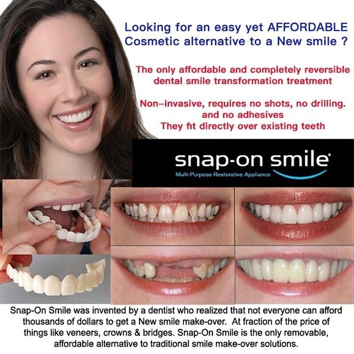 Latest👨⚕Adjustable Snap-On Dentures😁 (💥50% OFF) - 🔥HOT SALE🔥🎉