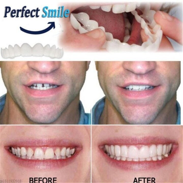 Latest👨⚕Adjustable Snap-On Dentures😁 (💥50% OFF) - 🔥HOT SALE🔥🎉