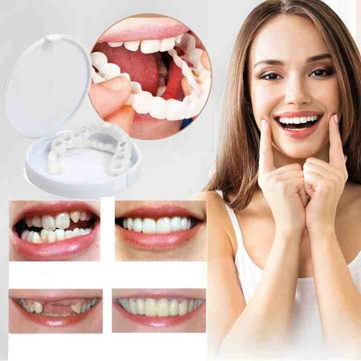 Latest👨⚕Adjustable Snap-On Dentures😁 (💥50% OFF) - 🔥HOT SALE🔥🎉