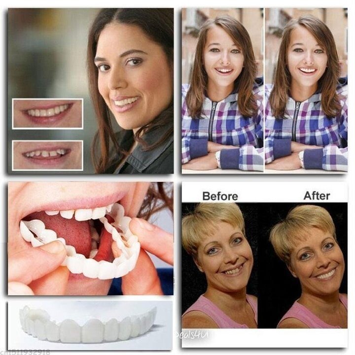 Latest👨⚕Adjustable Snap-On Dentures😁 (💥50% OFF) - 🔥HOT SALE🔥🎉